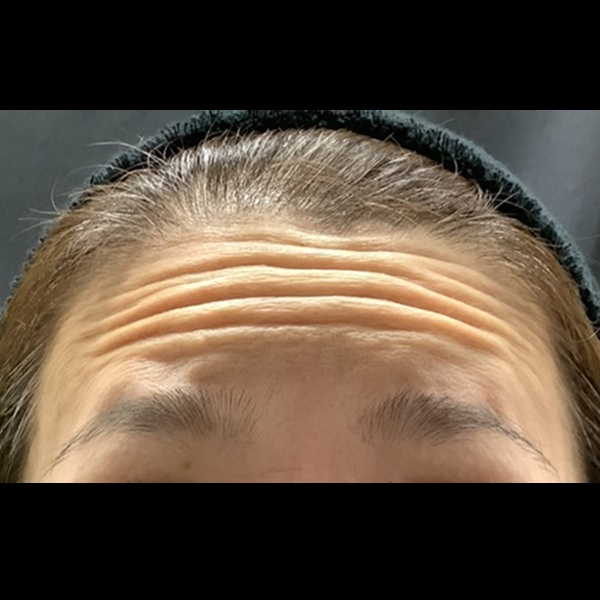 before画像