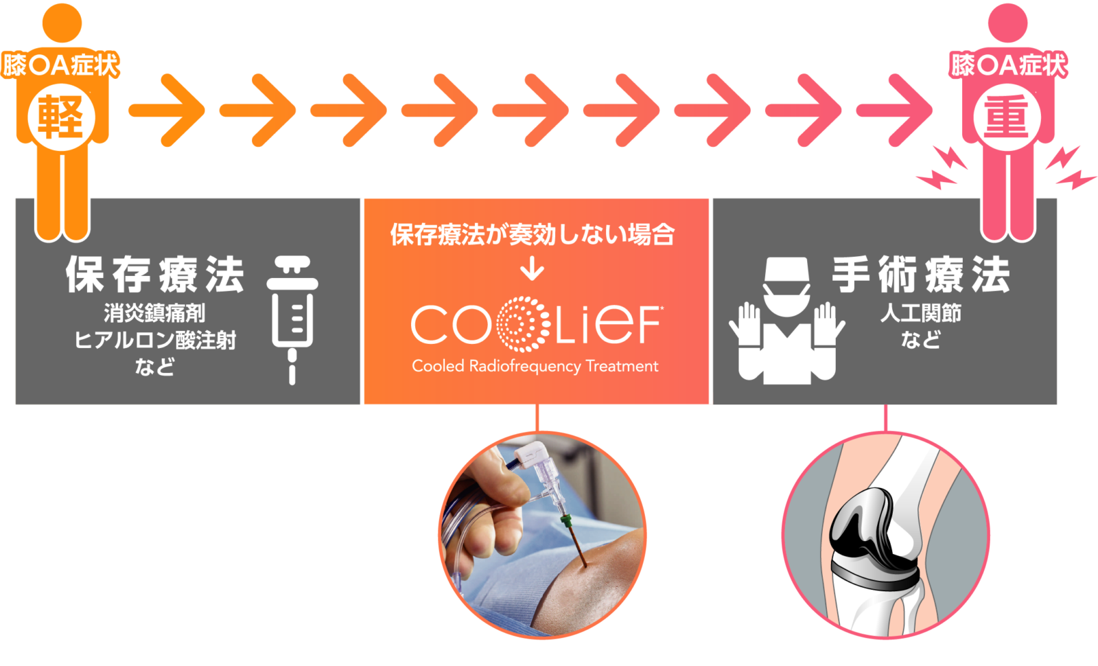 【膝の痛みで悩むあなたへ】注目の最新治療「クーリーフ」が新聞で紹介されました|三重タイムズ掲載