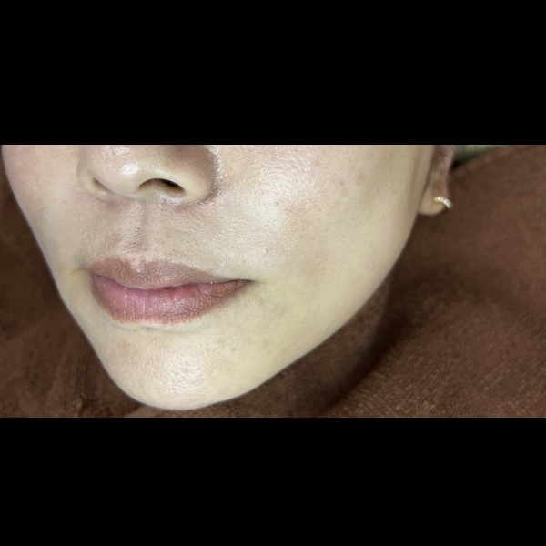 before画像