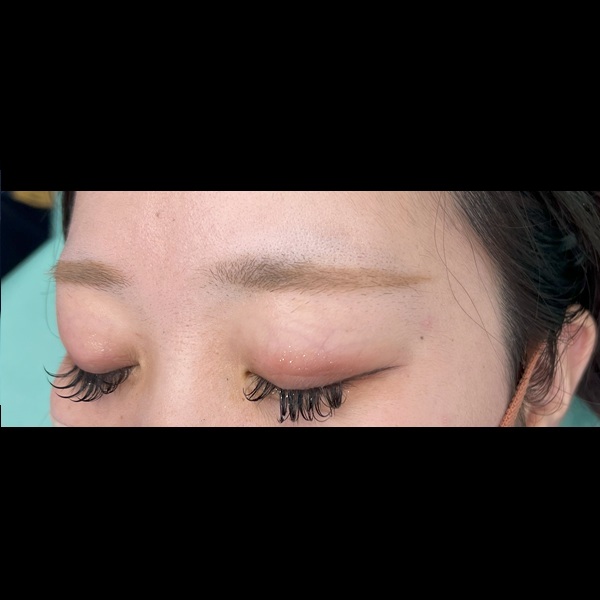 before画像