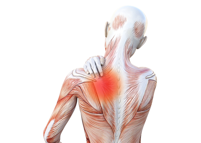 肩こりが治らない原因は鉄不足かも？フェリチン低値と中学生・女性の慢性肩こりを解説