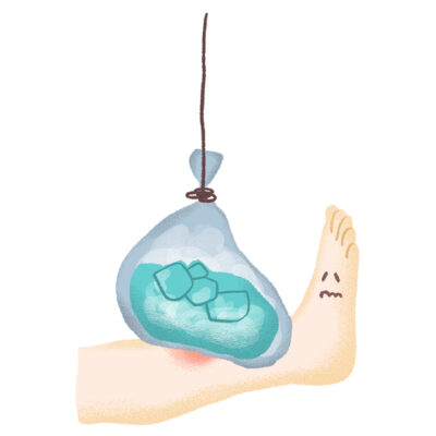 打撲の痛みが長引く方へ 動注治療を知っていますか?