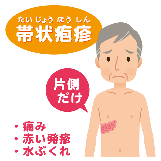 【背中や胸、腰の痛み…実は「帯状疱疹」かもしれません】