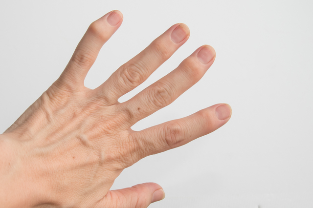 ヘバーデン結節の痛みが改善しない方へ｜原因・対処法・受診の目安