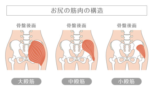 お尻の外側が痛い…それ、上殿神経障害かもしれません