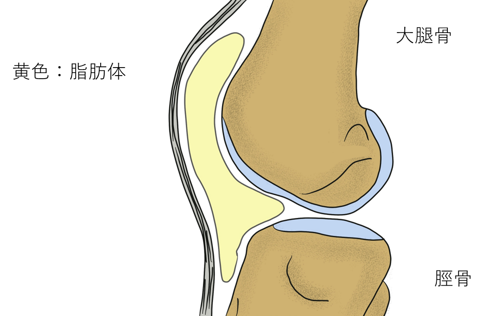 膝蓋下脂肪体炎